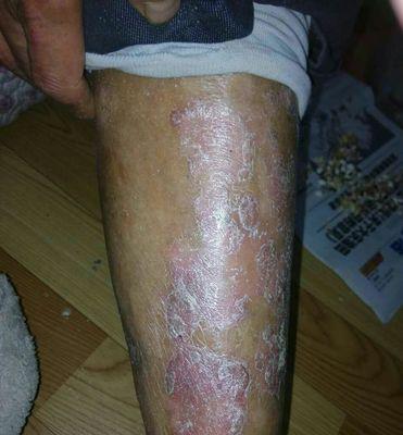 星光花蜜的正确使用方法是什么？使用后效果如何？